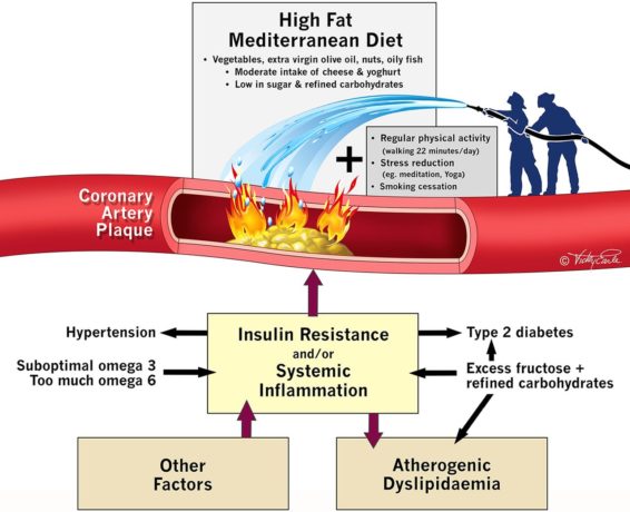 Saturated fat does not clog arteries and heart disease is more associated with carbohydrate than fat intake.